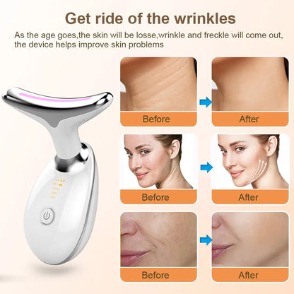 Neck Face Beauty Device EMS Neck Face Lifting Massager